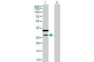 Lane 1: GSTA5 transfected lysate ( 24. (GSTA5 293T Cell Transient Overexpression Lysate(Denatured))