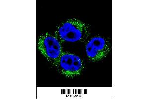 Confocal immunofluorescent analysis of AP1M1 Antibody with A375 cell followed by Alexa Fluor 488-conjugated goat anti-rabbit lgG (green).