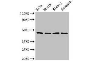 Western Blot Positive WB detected in: Hela whole cell lysate, Mouse brain tissue, Mouse kidney tissue, Mouse stomach tissue All lanes: NOB1 antibody at 1. (NOB1 anticorps  (AA 103-229))