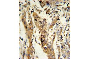 Immunohistochemistry (IHC) image for anti-Glutathione S-Transferase mu 1 (GSTM1) antibody (ABIN3002864) (GSTM1 anticorps)
