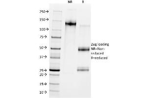 SDS-PAGE Analysis Purified MDM2 Mouse Monoclonal Antibody (SMP14).