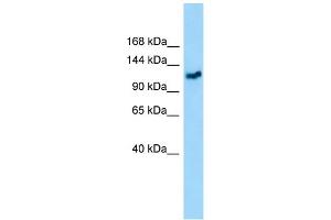WB Suggested Anti-GMIP Antibody Titration: 1. (GMIP anticorps  (C-Term))