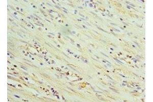 Immunohistochemistry of paraffin-embedded human epityphlon tissue using ABIN7172096 at dilution of 1:100