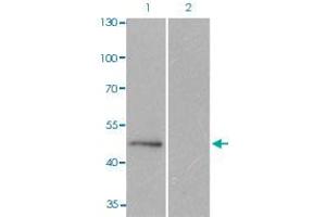 Western blot analysis of Lane 1: C6 cells, Lane 2: calf intestinal phosphatase (CIP) treated C6 cells with MAPT (phospho S404) polyclonal antibody  at 1:500-1:1000 dilution.