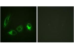 Immunofluorescence analysis of HeLa cells, using IRS-1 (Phospho-Ser323) Antibody. (IRS1 anticorps  (pSer323))
