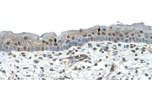Human Skin (TR4 anticorps  (C-Term))