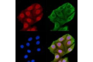 ABIN6262710 and ABIN6269260 staining HepG2 cells by IF/ICC. (JNK anticorps)