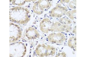 Immunohistochemistry of paraffin-embedded Human stomach using CGB7 Polyclonal Antibody at dilution of 1:100 (40x lens). (CGB7 anticorps)