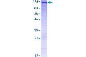 Image no. 1 for HAUS Augmin-Like Complex, Subunit 6 (HAUS6) (AA 1-955) protein (GST tag) (ABIN1353521)