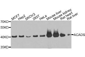 Western blot analysis of extracts of various cell lines, using ACADS antibody. (ACADS anticorps)