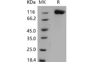 Western Blotting (WB) image for Oncostatin M Receptor (OSMR) protein (His tag) (ABIN7197241)