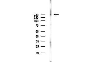 anti-Mechanistic Target of Rapamycin (serine/threonine Kinase) (mTOR) antibody