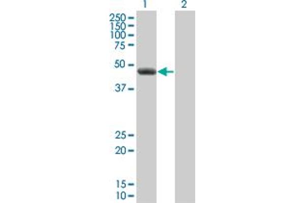 CLP1 anticorps  (AA 316-425)