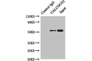 Immunoprecipitating CALCOCO2 in Hela whole cell lysate Lane 1: Rabbit control IgG instead of (1 μg) instead of ABIN7146349 in Hela whole cell lysate.