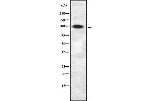 Western blot analysis of APBB1IP using COLO205 whole  lysates.