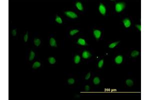 Immunofluorescence of monoclonal antibody to SETX on HeLa cell.