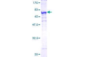 Image no. 1 for Proteasome (Prosome, Macropain) 26S Subunit, ATPase, 4 (PSMC4) (AA 1-418) protein (GST tag) (ABIN1316605)