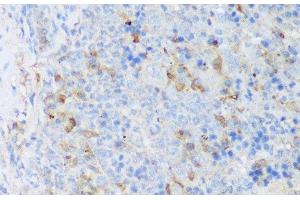 Immunohistochemistry of paraffin-embedded Mouse spleen using CRACR2A Polyclonal Antibody at dilution of 1:150 (40x lens). (EFCAB4B anticorps)