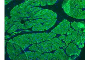 Image no. 1 for anti-Smoothelin (SMTN) antibody (ABIN335397)