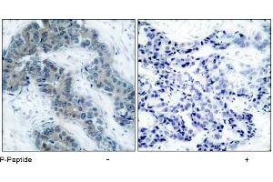 Image no. 1 for anti-Janus Kinase 2 (JAK2) (pTyr1007) antibody (ABIN196872) (JAK2 anticorps  (pTyr1007))