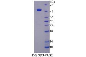 SDS-PAGE analysis of Rat KNG1 Protein. (KNG1 Protéine)