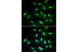 Immunofluorescence analysis of HepG2 cell using CD46 antibody.