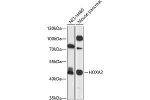 Western blot analysis of extracts of various cell lines, using HOX antibody (ABIN6128061, ABIN6141938, ABIN6141939 and ABIN6225060) at 1:1000 dilution. (HOXA2 anticorps  (AA 207-376))