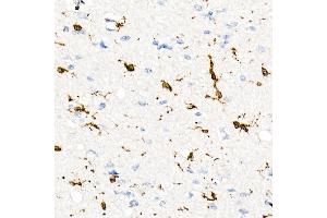 Immunohistochemistry of paraffin-embedded Human brain using CD74 antibody (ABIN7267759) at dilution of 1:100 (40x lens).