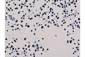 ICC staining of human HepG2 cells with recombinant H3K56ac antibody.