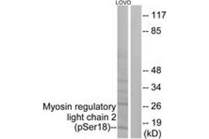 Western blot analysis of extracts from LOVO cells treated with H2O2 100uM 30', using Myosin regulatory light chain 2 (Phospho-Ser18) Antibody. (MYL12B anticorps  (pSer18))