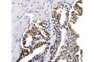 IHC analysis of NOLA1/GAR1 using anti-NOLA1/GAR1 antibody (ABIN7602076). (GAR1 anticorps  (AA 58-165))