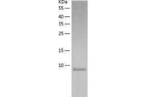 Western Blotting (WB) image for FK506 Binding Protein 1A, 12kDa (FKBP1A) (AA 1-108) protein (His tag) (ABIN7122972)