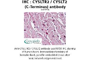 Image no. 1 for anti-Cysteinyl Leukotriene Receptor 2 (CYSLTR2) (C-Term), (Cytoplasmic Domain) antibody (ABIN1733464)