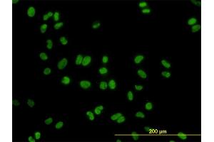 Immunofluorescence of monoclonal antibody to DDX41 on HeLa cell. (DDX41 anticorps  (AA 523-622))
