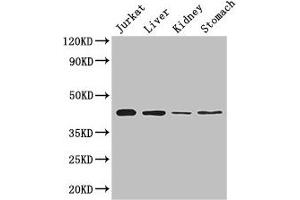 Western Blot Positive WB detected in: Jurkat whole cell lysate, Mouse liver tissue, Mouse kidney tissue, Mouse stomach tissue All lanes: Hoxa2 antibody at 2 μg/mL Secondary Goat polyclonal to rabbit IgG at 1/50000 dilution Predicted band size: 42 kDa Observed band size: 42 kDa (HOXA2 anticorps  (AA 26-124))