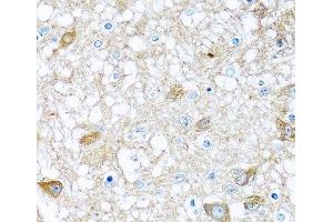 Immunohistochemistry of paraffin-embedded Rat brain using BMP5 Polyclonal Antibody at dilution of 1:100 (40x lens).