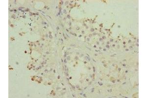 Immunohistochemistry of paraffin-embedded human testis tissue using ABIN7159960 at dilution of 1:100 (PMPCB anticorps  (AA 110-380))