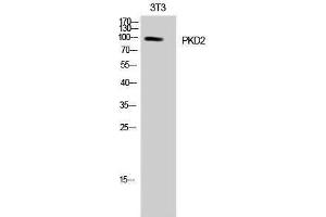 Western Blotting (WB) image for anti-Polycystic Kidney Disease 2 (Autosomal Dominant) (PKD2) (Tyr654) antibody (ABIN3176934) (PKD2 anticorps  (Tyr654))