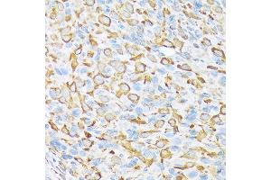 Immunohistochemistry of paraffin-embedded rat ovary using Sec23AA Rabbit mAb (ABIN7270168) at dilution of 1:100 (40x lens). (SEC23A anticorps)