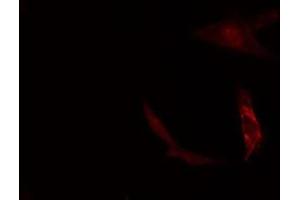 ABIN6277117 staining  Hela cells by IF/ICC. (ZYX anticorps  (Internal Region))