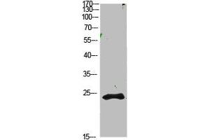 Western Blot analysis of 1,mouse-kidney cells using primary antibody diluted at 1:1000(4 °C overnight). (Cardiotrophin 1 anticorps  (AA 151-200))