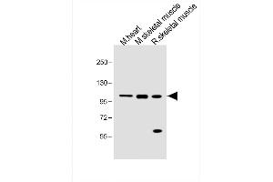 All lanes : Anti-Mouse Csf1r Antibody (C-term) at 1:1000 dilution Lane 1: Mouse heart lysate Lane 2: Mouse skeletal muscle lysate Lane 3: Rat skeletal muscle lysate Lysates/proteins at 20 μg per lane.