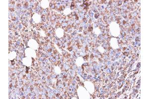 IHC-P Image Immunohistochemical analysis of paraffin-embedded SAS xenograft, using RPS3, antibody at 1:500 dilution.