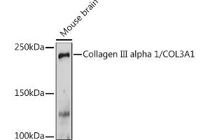 Western blot analysis of extracts of Mouse brain, using Collagen III alpha 1/COL3 Rabbit pAb (ABIN1679317, ABIN3018108, ABIN3018109 and ABIN6220366) at 1:1000 dilution. (COL3A1 anticorps  (AA 1217-1466))