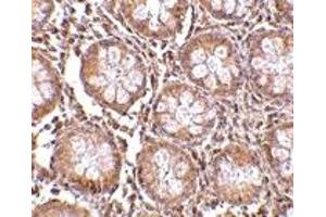 Immunohistochemistry (IHC) image for anti-CD248 Molecule, Endosialin (CD248) (N-Term) antibody (ABIN1031609)