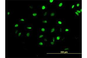 Immunofluorescence of purified MaxPab antibody to CENPH on HeLa cell.