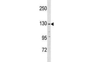 Anti-EGF antibody western blot analysis in K562 lysate (EGF anticorps  (AA 940-967))
