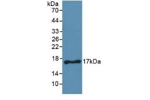 Detection of Recombinant CD40L, Human using Monoclonal Antibody to Cluster Of Differentiation 40 Ligand (CD40L) (CD40 Ligand anticorps  (AA 180-261))