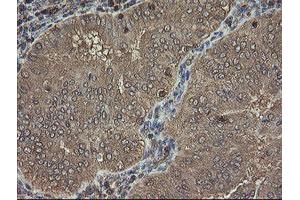 Image no. 15 for anti-PHD Finger Protein 7 (PHF7) (AA 155-381) antibody (ABIN1490975)