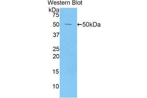 Western Blotting (WB) image for anti-Peroxiredoxin 1 (PRDX1) (AA 1-199) antibody (ABIN1860301) (Peroxiredoxin 1 anticorps  (AA 1-199))